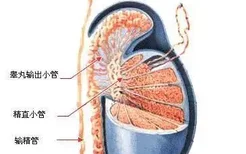 不止输卵管会堵，输精管也能堵