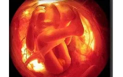 胎儿的哪些因素会导致难产