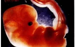 怀孕1个月：胎儿只是一个胚胎