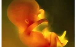 孕妇为什么会发生胎膜早破