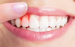 产后牙龈红肿出血什么原因 跟坐月子的习俗有关